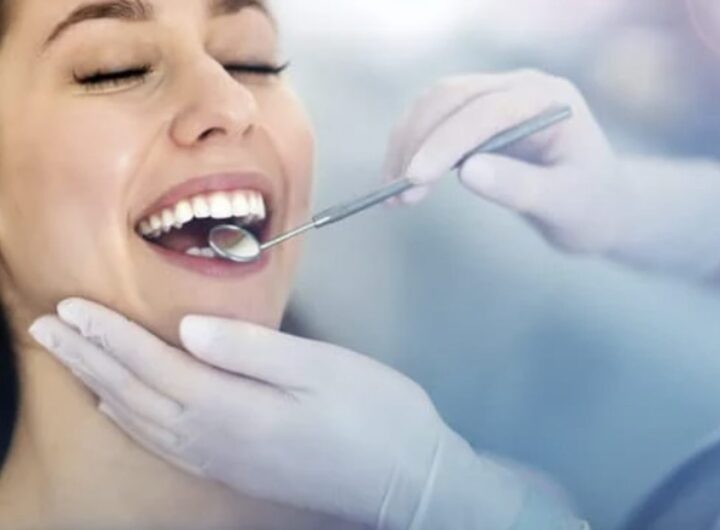 Sebbene il bicarbonato di sodio sia un rimedio popolare per lo sbiancamento dentale, esistono altri metodi e prodotti che possono offrirti