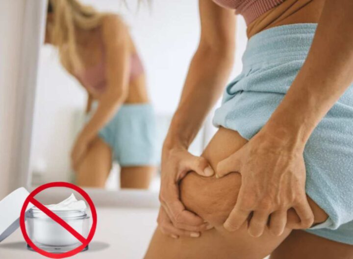 Anti-cellulite