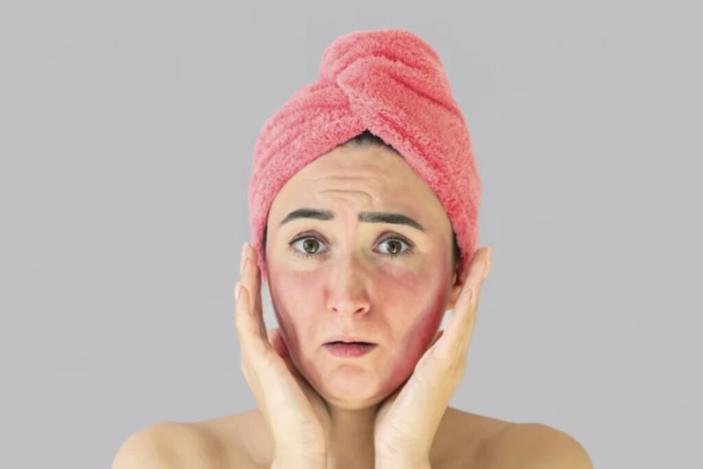 Nonostante la vasta offerta di prodotti cosmetici e farmaceutici per prevenirle e alleviarle, esiste un rimedio naturale semplice ed efficace,