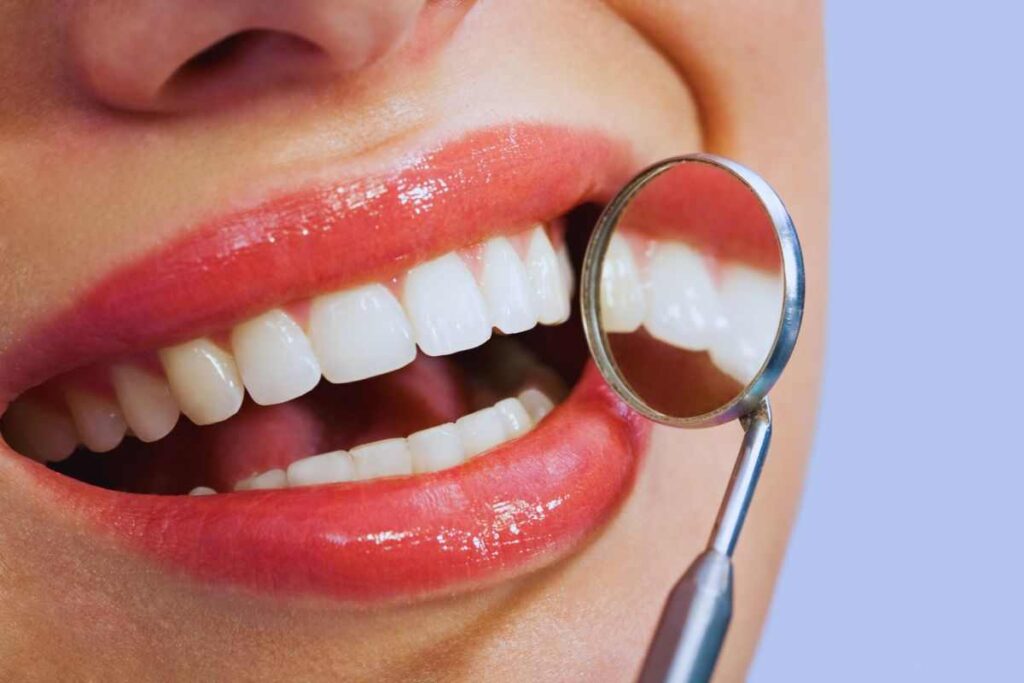 denti bianchissimi: come averli