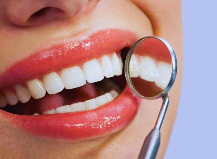 denti bianchissimi: come averli