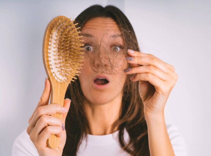 Perché in estate cadono i capelli?