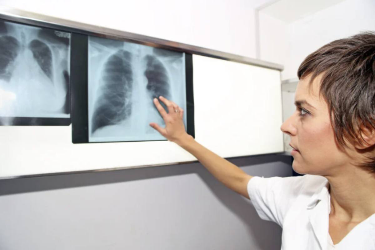 a difficoltà nel riconoscere tempestivamente l’ipertensione polmonare rende fondamentale un approccio multidisciplinare