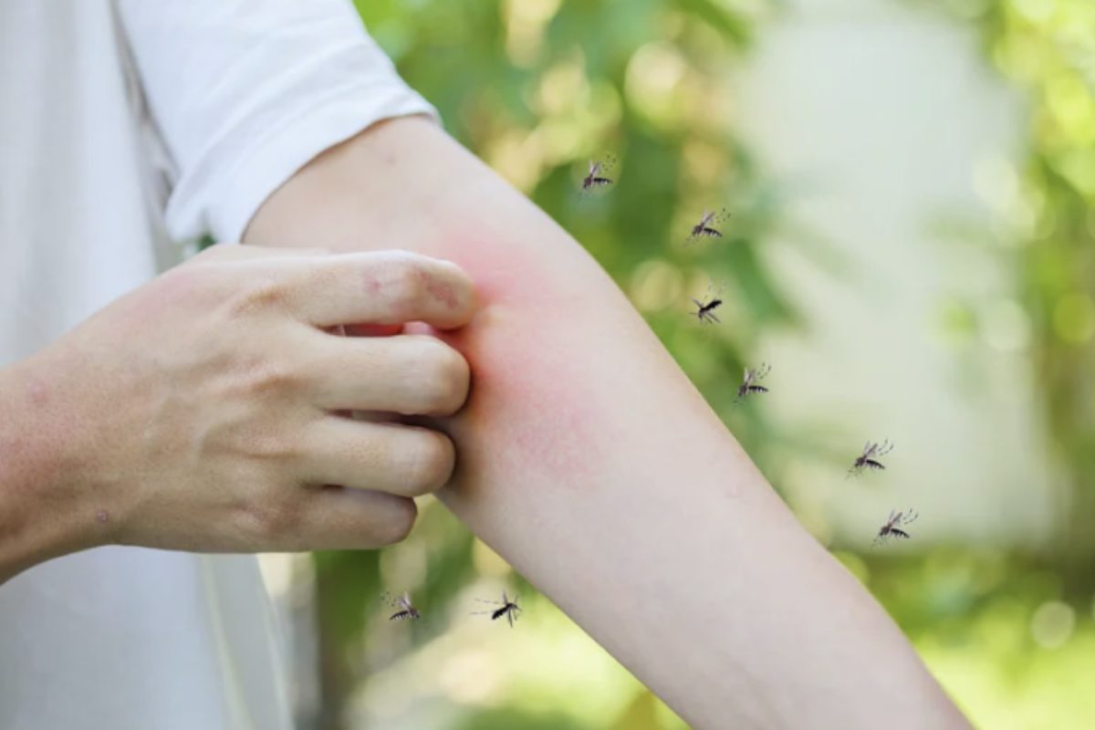 La prevenzione rimane la principale arma contro il fastidio e il rischio sanitario legato alle zanzare. Gli esperti consigliano di adottare