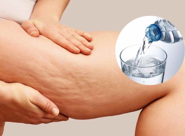 acqua funzionale contro cellulite e grassi, funziona davvero?