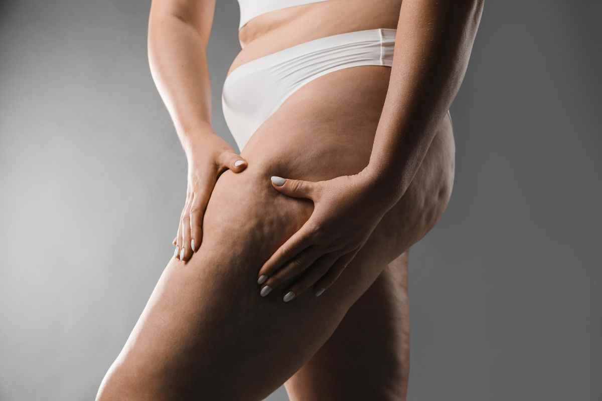 acqua funzionale contro cellulite e grassi, funziona davvero?