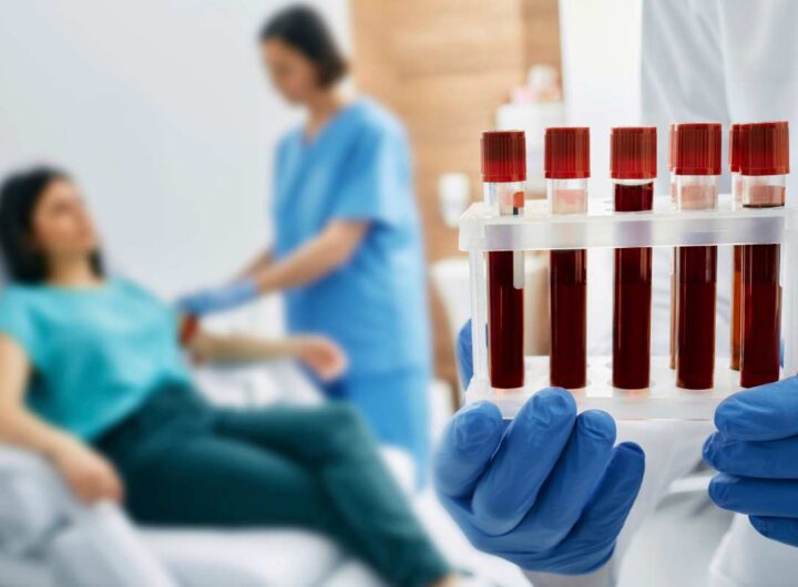 prelievo sangue scoperta choc