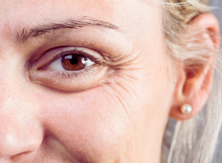 Il solo ingrediente che distrugge ogni ruga sul tuo volto