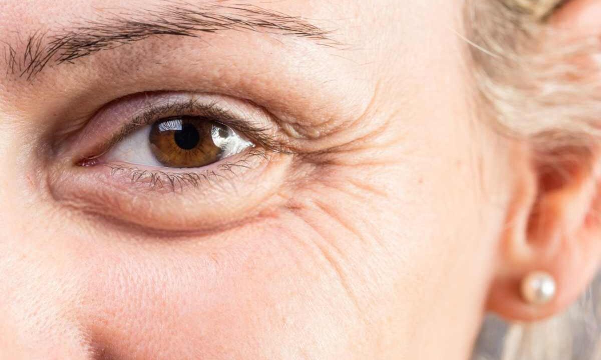 Qual è la crema antirughe più venduta?