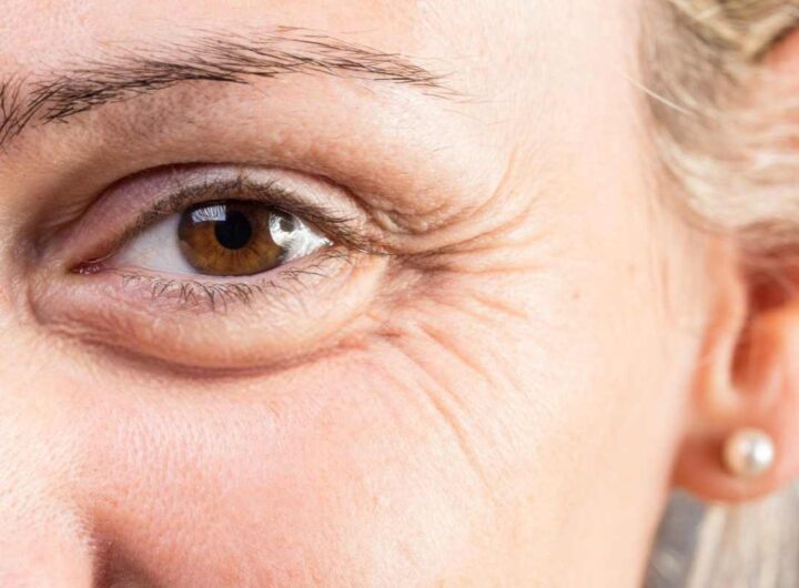 Qual è la crema antirughe più venduta?
