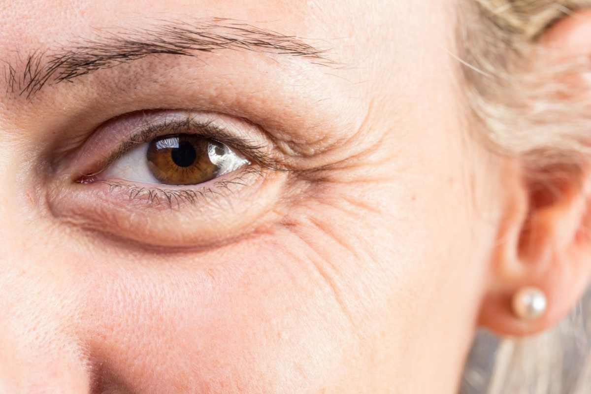 Qual è la crema antirughe più venduta?