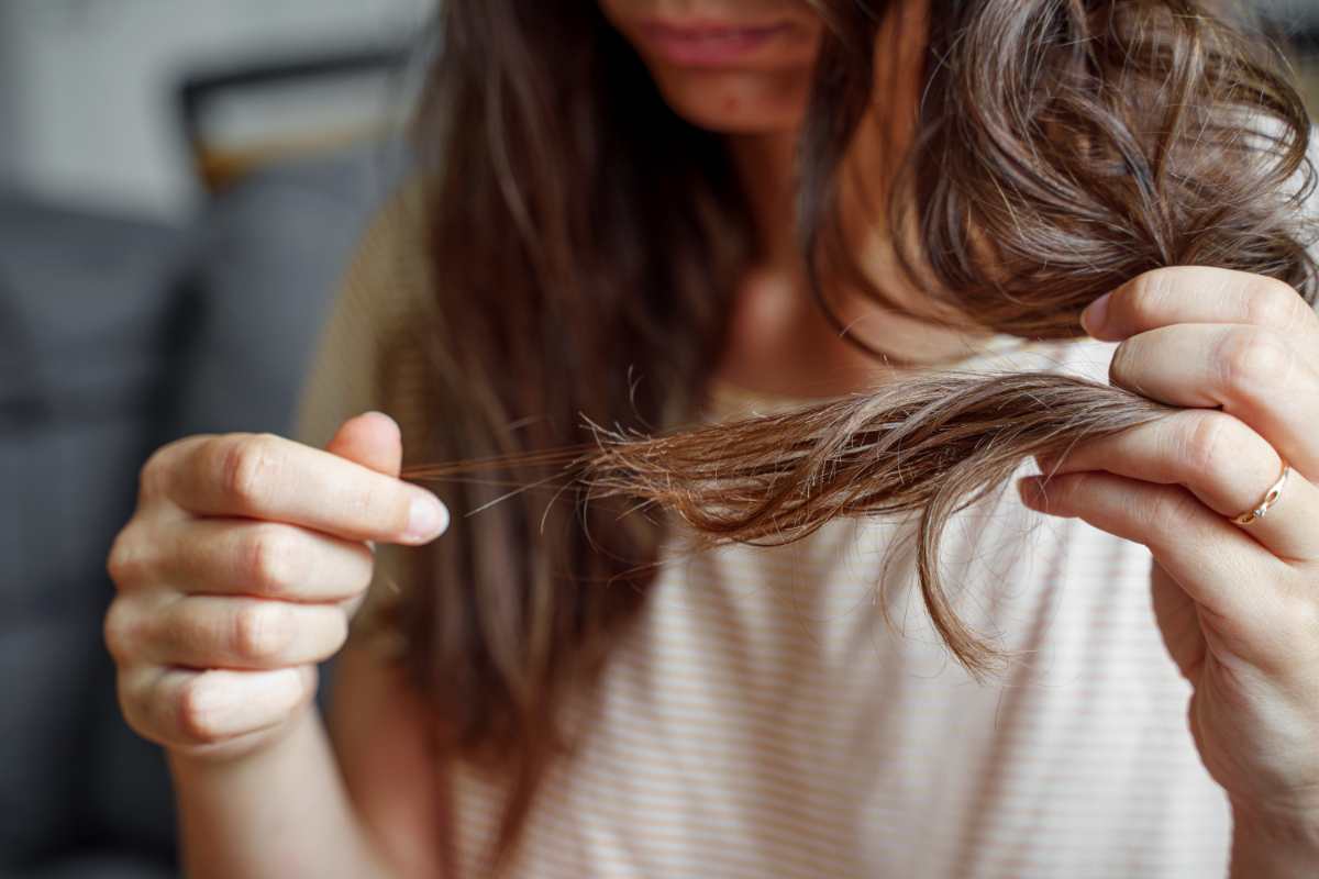 Caduta capelli