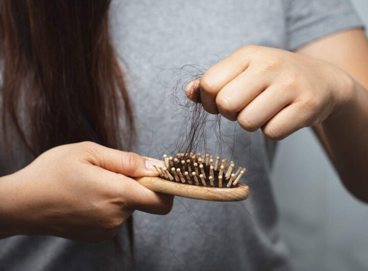 Caduta capelli