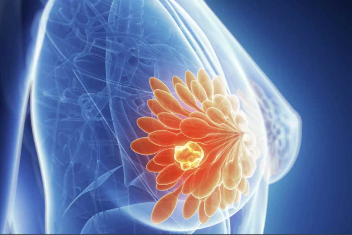 Il Policlinico Umberto I di Roma, ospedale universitario e centro di eccellenza, ospita una Breast Unit, una struttura integrata