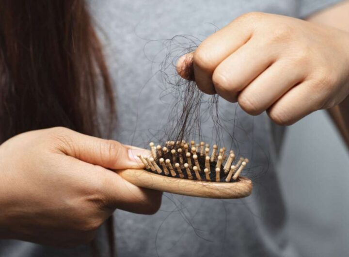 caduta capelli