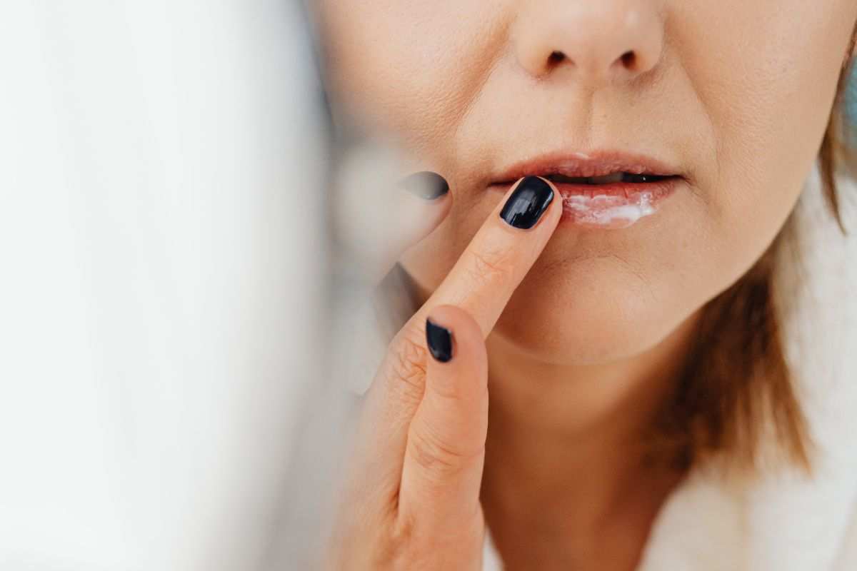 labbra screpolate: i rimedi