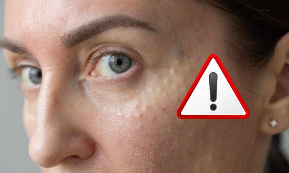 se non dormi correttamente la tua pelle invecchia precocemente