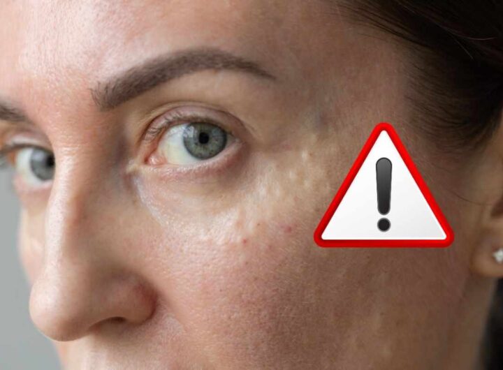 se non dormi correttamente la tua pelle invecchia precocemente