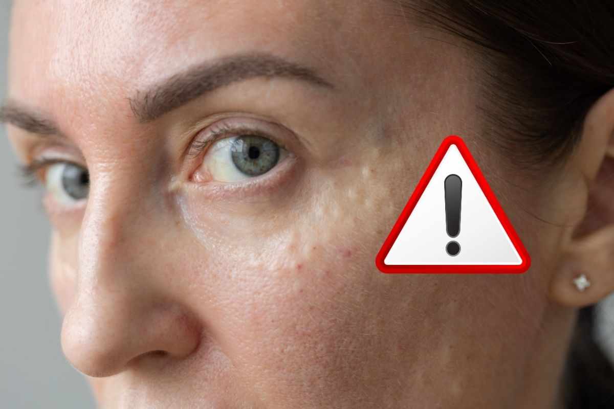 se non dormi correttamente la tua pelle invecchia precocemente